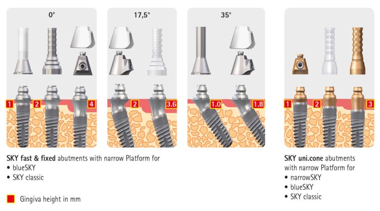 SKY prosthetics (narrowSKY - blueSKY- classicSKY)